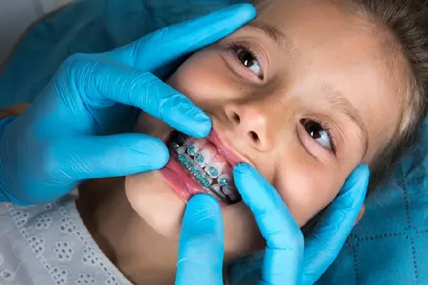 Early orthodontic treatment