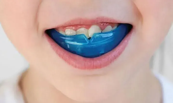 Myofunctional appliance worn by a child