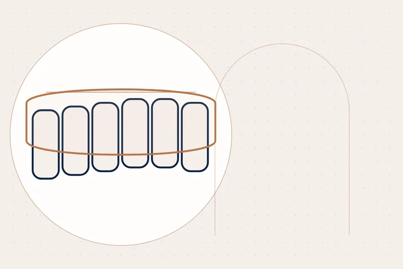 Gaps Between Teeth: causes and treatment — illustration