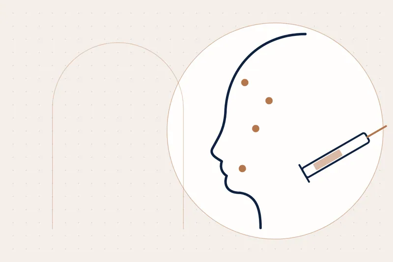 Keloids & Raised Scars: causes and treatment — illustration