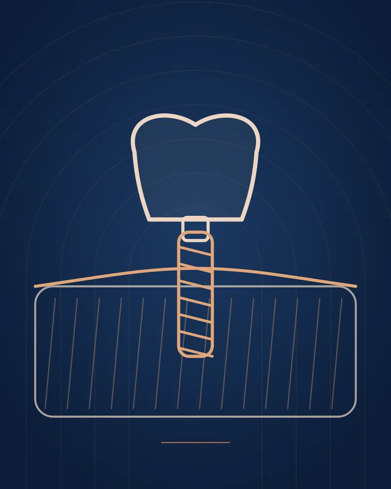 Missing Teeth — educational illustration