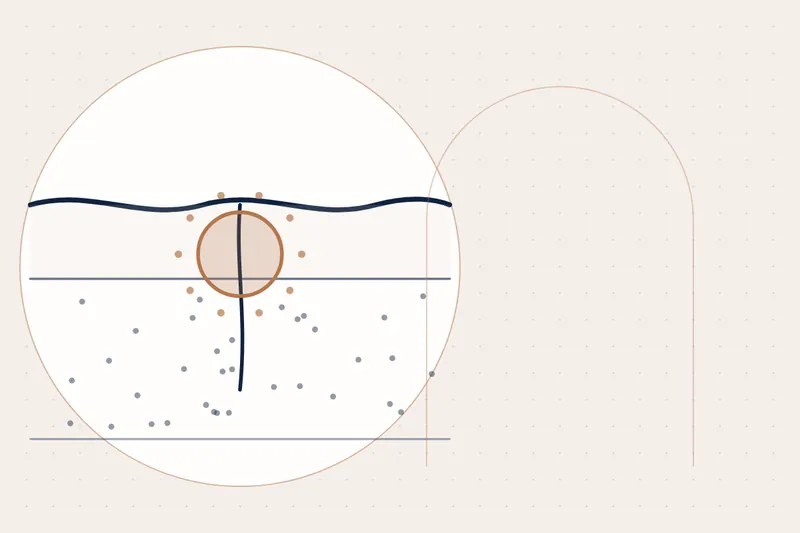 Dark Marks After Acne (PIH): causes and treatment — illustration