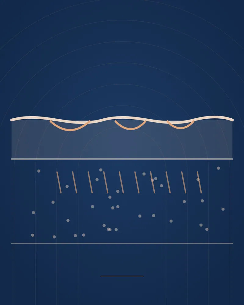 Stretch Marks — educational illustration