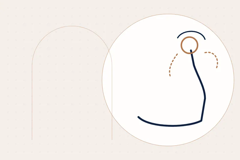 Underbite: causes and treatment — illustration