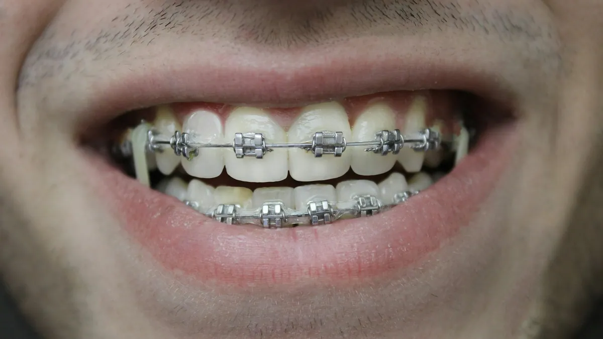 Orthodontics in Dubai — Manhal Medical Center
