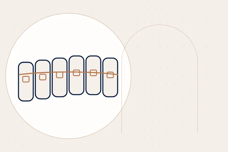Orthodontics at Manhal Medical Center