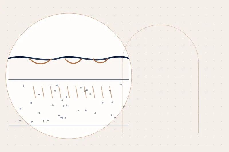 CO2 Laser Treatment explained — educational illustration