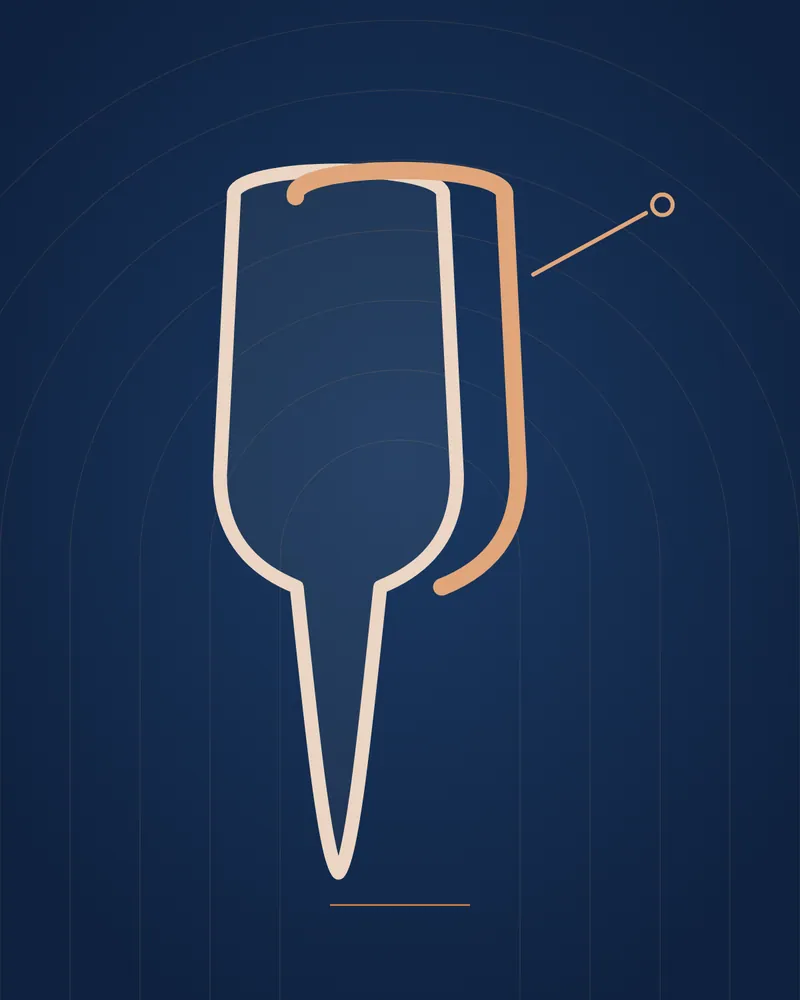 Composite Bonding — illustration, Manhal Medical Center Dubai