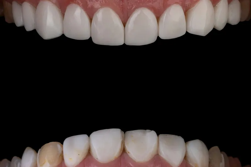Best gum specialist in Dubai: what good gum disease care should include — Manhal Medical Center, Dubai
