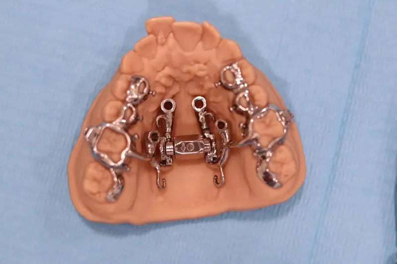 How to choose the best TMJ specialist in Dubai for jaw pain and clicking — Manhal Medical Center, Dubai