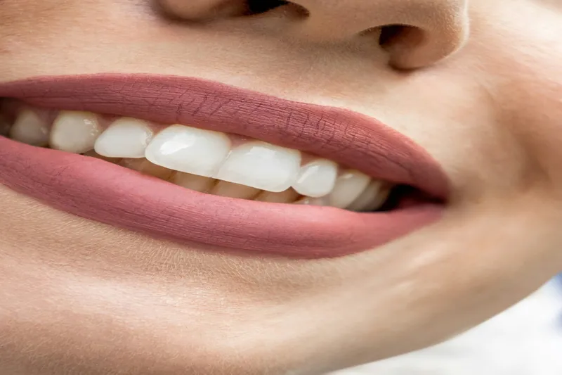 عيوب جسر الأسنان ومميزاته — مركز منهل الطبي، دبي