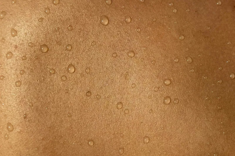 Dry skin treatment in Dubai — Manhal Medical Center, Dubai