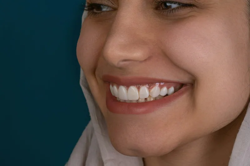 Flexible dentures in Dubai — Manhal Medical Center, Dubai