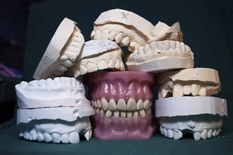 Full mouth dental implants cost in Dubai — Manhal Medical Center, Dubai