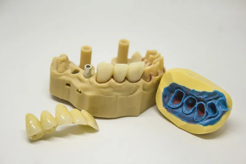 Full mouth rehabilitation in Dubai — Manhal Medical Center, Dubai