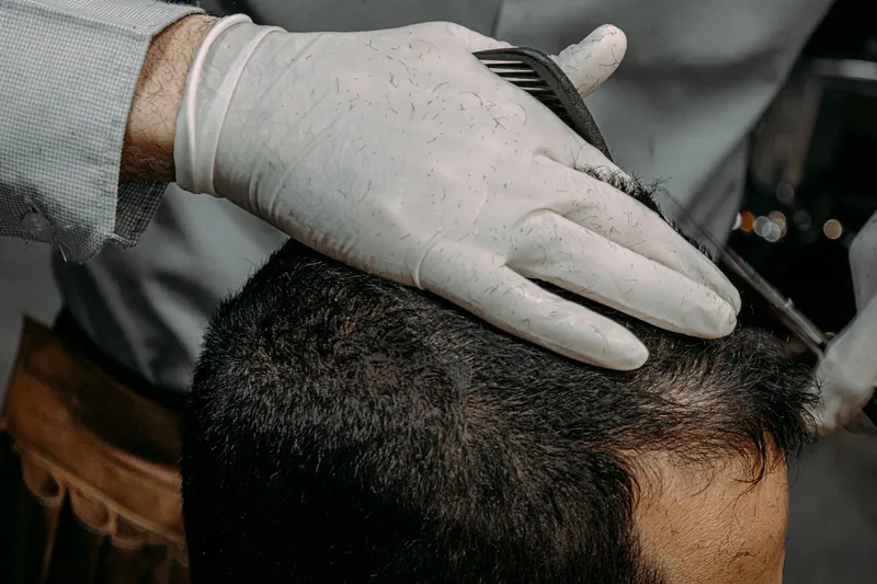 Keratosis pilaris treatment — Manhal Medical Center, Dubai
