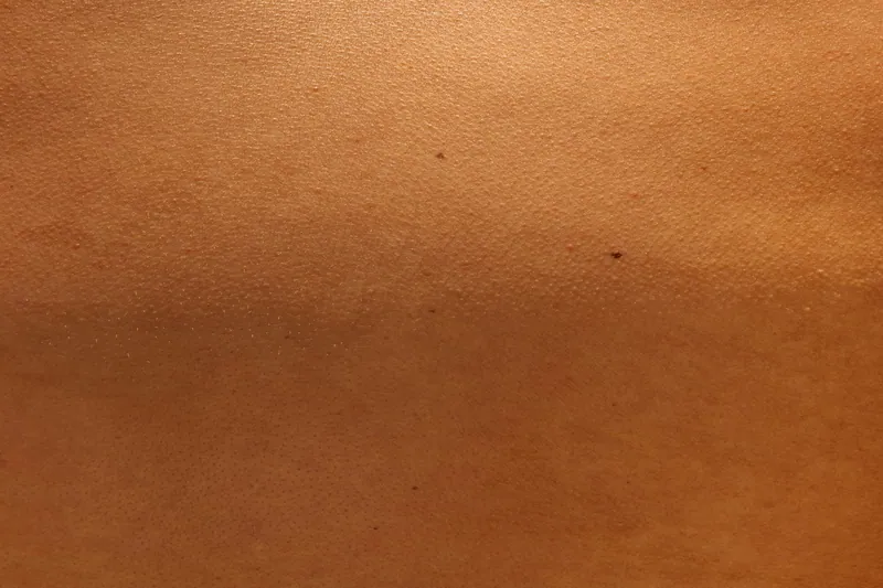 Microneedling in Dubai — Manhal Medical Center, Dubai