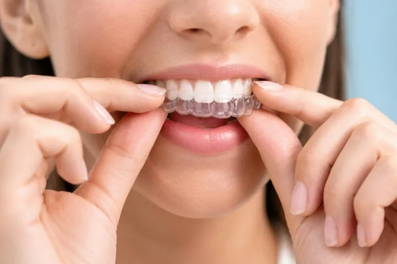 Mouth breathing in adults: dry mouth, poor sleep and the role of a narrow palate — Manhal Medical Center, Dubai