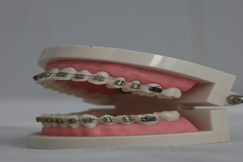 Orthodontist in Dubai — Manhal Medical Center, Dubai