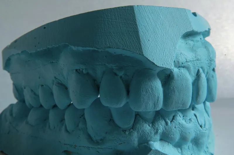 Same-day and immediate dental implants in Dubai — Manhal Medical Center, Dubai