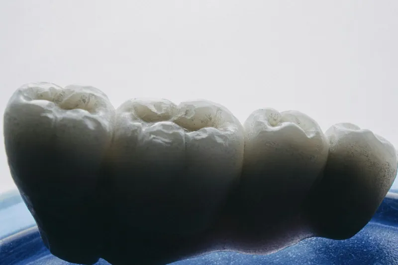 تيجان الزركونيا في دبي — مركز منهل الطبي، دبي