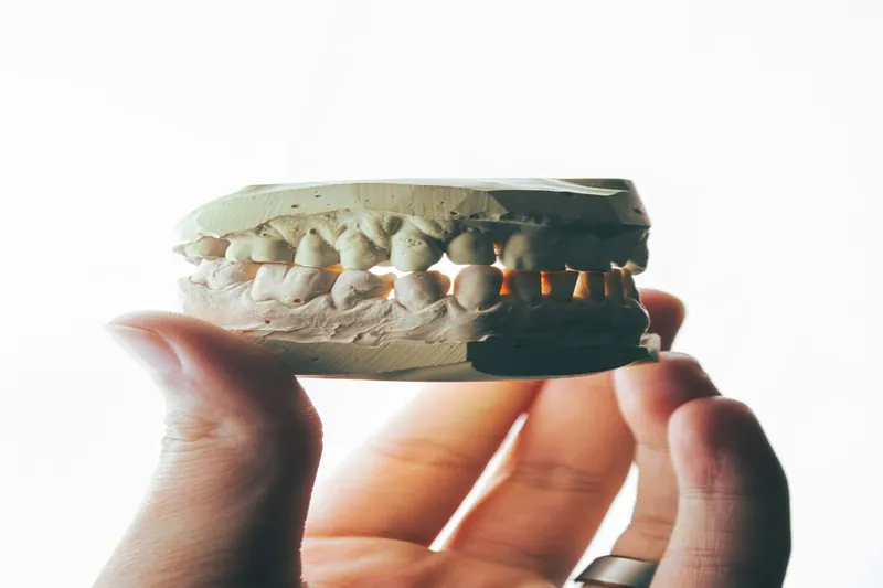 Zygomatic implants in Dubai — Manhal Medical Center, Dubai