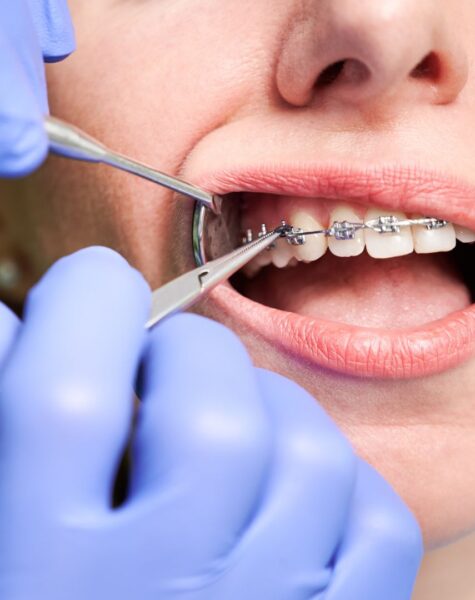 2e2c81bcf6d65ea8334d7bcd1ef2fab0