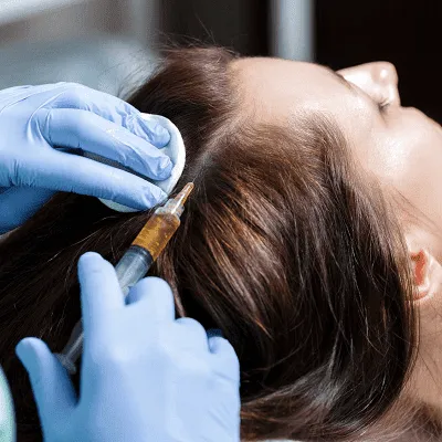 Cost-of-Hair-Filler-Treatment-in-Islamabad-Pakistan
