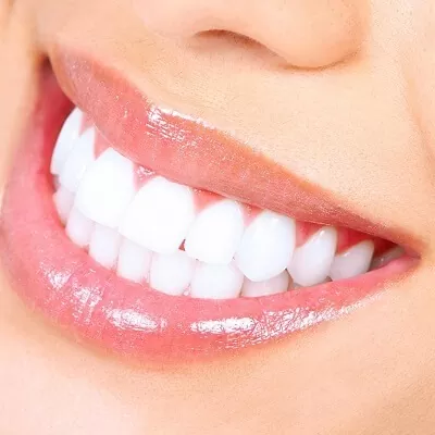Zoom-Teeth-Whitening-in-Dubai-UAE-Abu-Dhabi-Laser-Tooth-Whiten-Cost