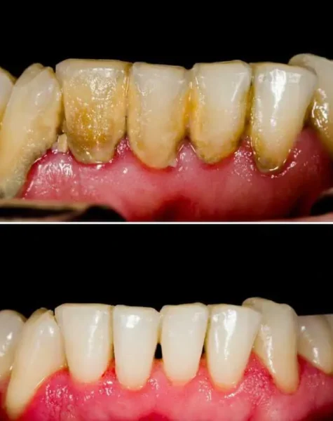 periodontal-disease-symptoms-and-treatment-dentist.jpg